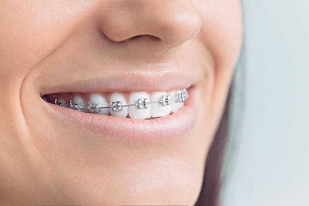 Best Traditional Braces  in Annandale, NJ